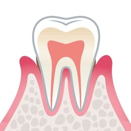 岡山市北区東古松の歯医者「すまいるフレンド歯科」 軽度歯周病